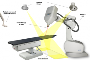 cyberknife