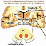 Le aree del cervello interessate dal Parkinson