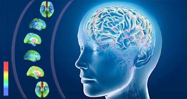 Alzheimer: ultrasuoni ripristinano la memoria