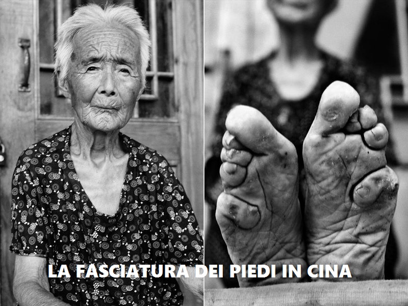 fasciatura dei piedi