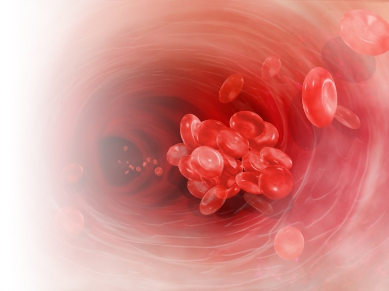 Xarelto – il pericoloso anticoagulante continua a mietere vittime