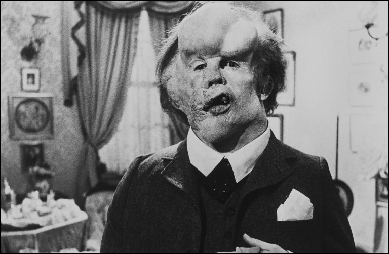 Elephant Man: la bellezza secondo David Lynch