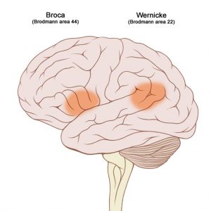 broca wernicke